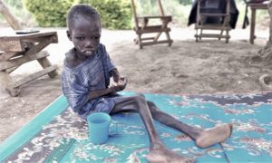 Read more about the article Jovan, a victim of child torture